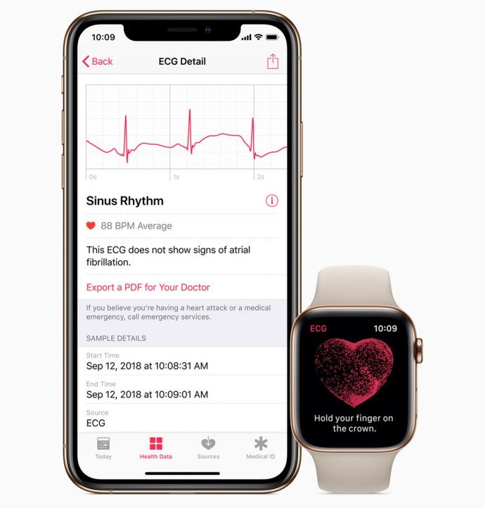 Apple Watch ECG app Singapore Review irregular rhythm notification