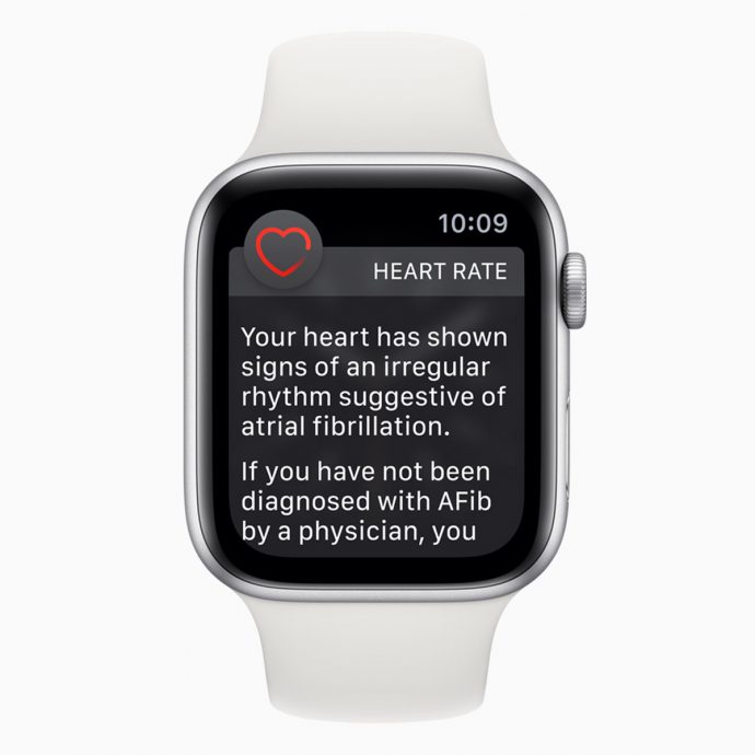 Apple Watch ECG app Singapore Review irregular rhythm notification